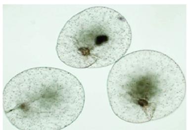 رخداد بلوم جلبکی