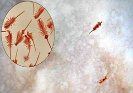 دریاچه ارومیه یکی از زیستگاه‌های مهم جهانی برای آرتمیا است