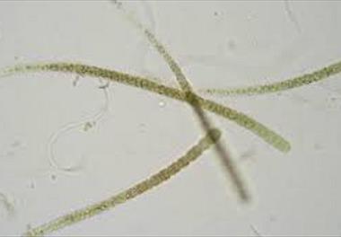 گزارش وجودگونه سمی و مضر فیتوپلانکتونی در آبهای ساحلی منطقه امیر آباد دریای خزر