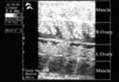 بررسی امکان انتقال ماهیان خاویاری نارس صید شده به محلهای پرورشی