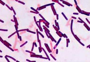 تاثير جیره ای حاوی پروبیوتیک Bacillus subtilis IS02 بر شاخص هاي سلامتی، عملکرد سیستم ايمني و پیشگیری از بیماری لکه سفید در ميگوي سفيد غربي