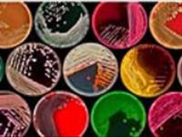 روش های شناسایی باکتر یهای گرم منفی ( خانواده آنتروباكترياسه) در اکوسیستم های آبی